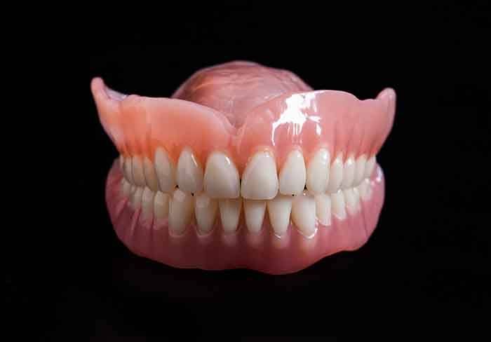 an upper and lower full denture